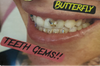 Teeth Gems *-downpayment*