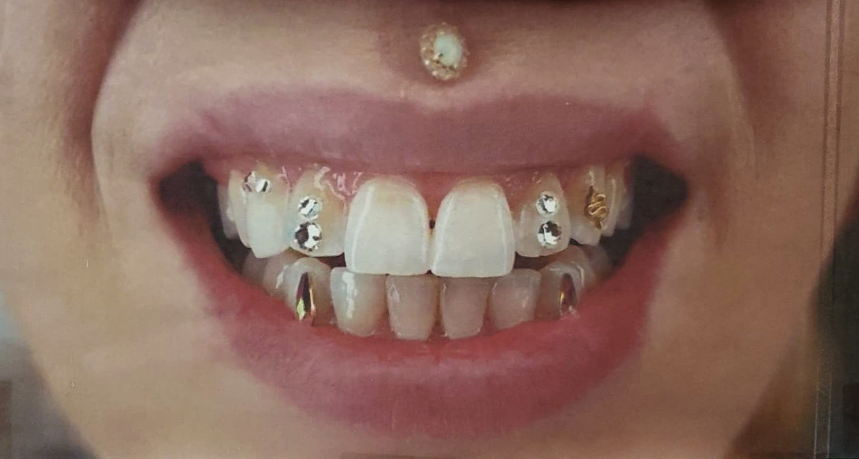 Teeth Gems *-downpayment*